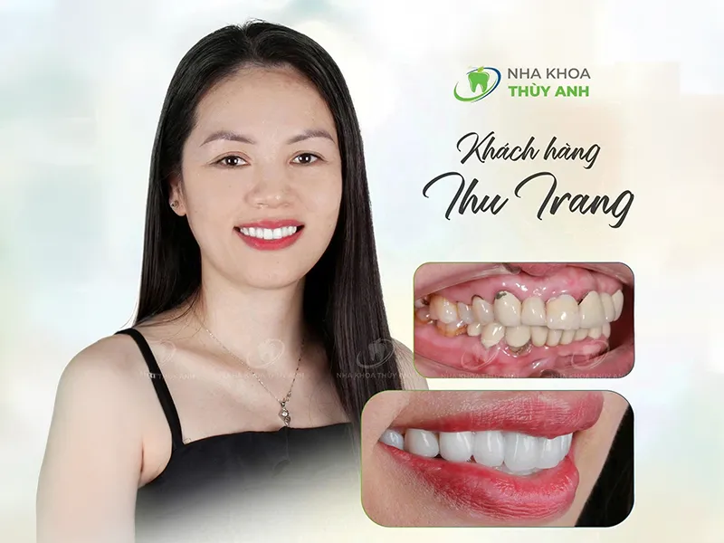 Chị Thu Trang – Việt kiều Cộng hòa Séc