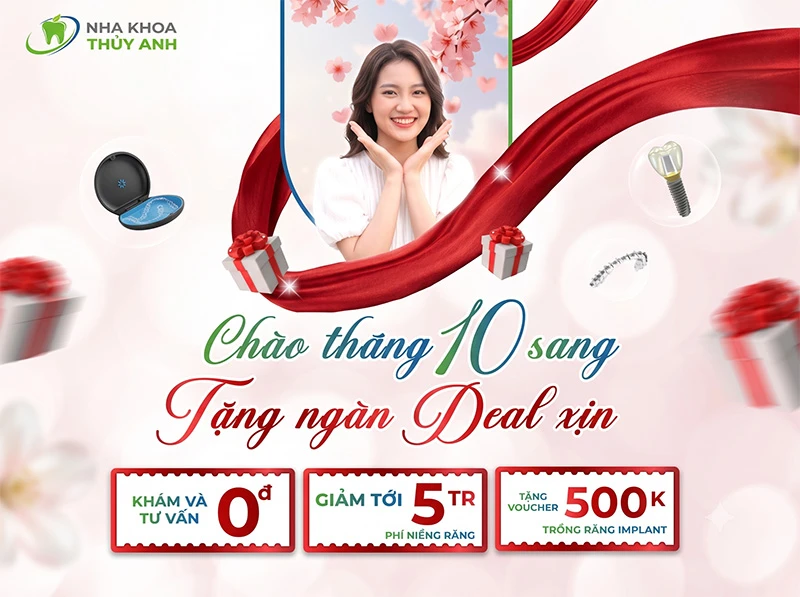 CHƯƠNG TRÌNH ƯU ĐÃI THÁNG