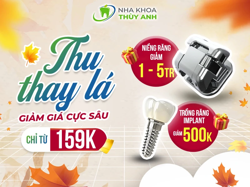 CHƯƠNG TRÌNH ƯU ĐÃI THÁNG