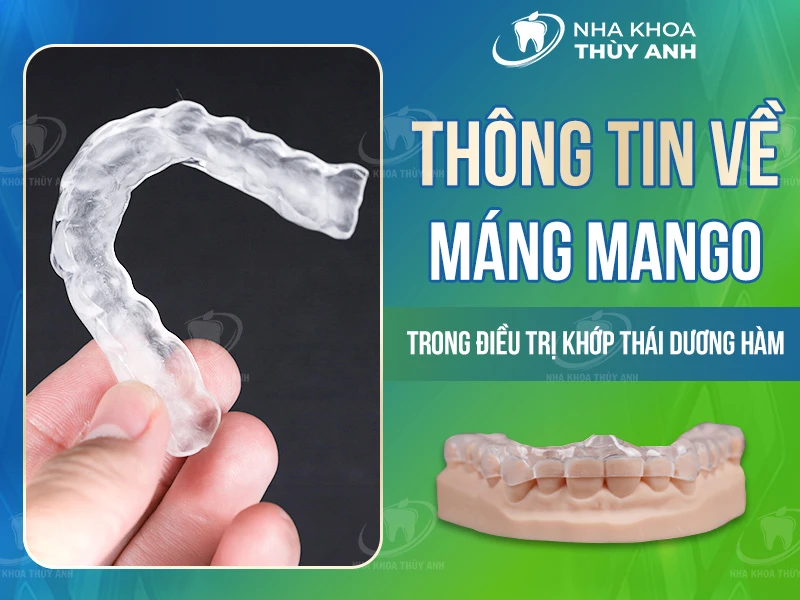 Thông tin về máng mago trong điều trị khớp thái dương hàm