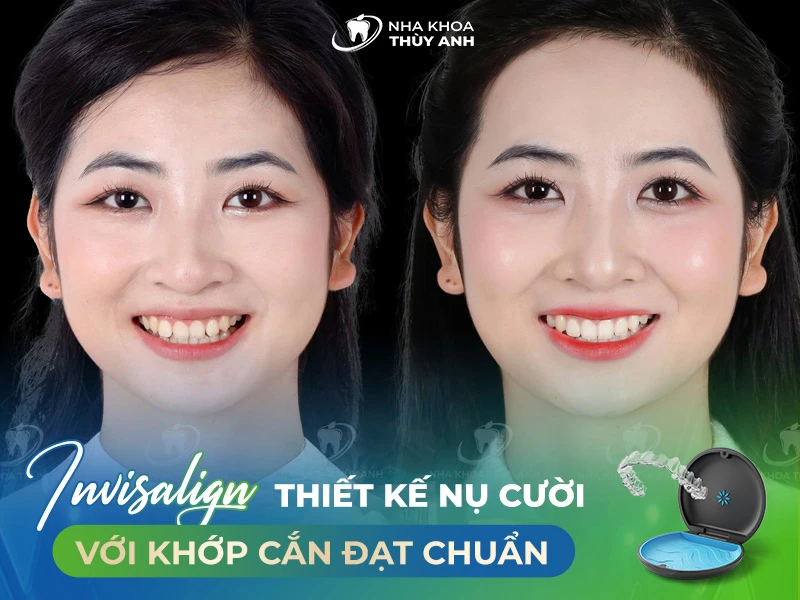 Linh Chi – 26 tuổi 