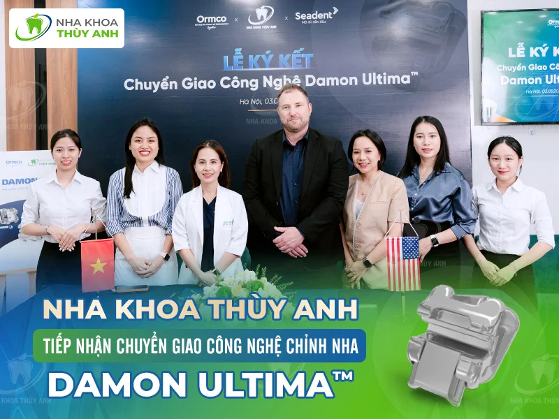 Nha khoa Thùy Anh tiếp nhận chuyển giao công nghệ chỉnh nha Damon Ultima