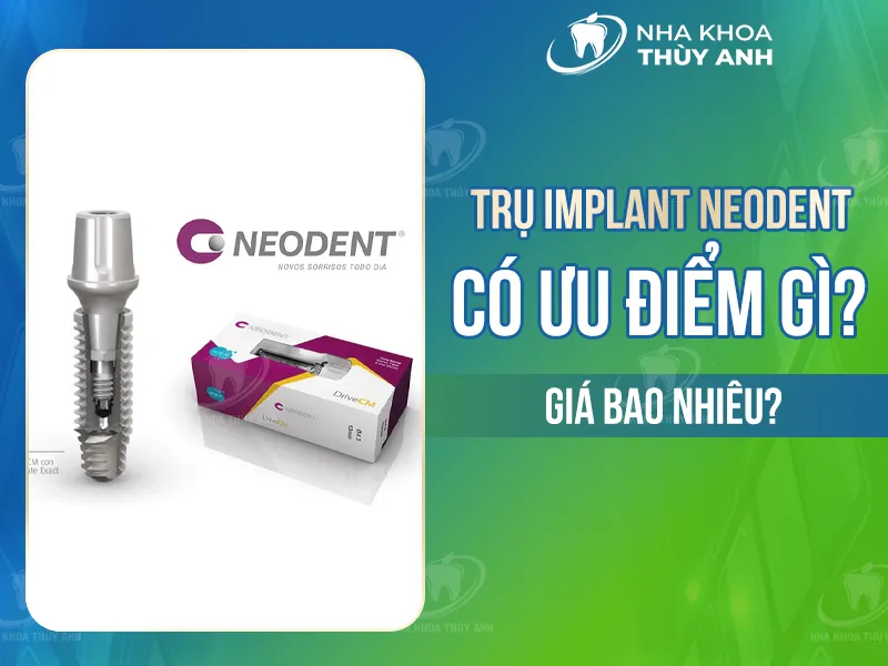 Trụ Implant Neodent có ưu điểm gì? Chi phí là bao nhiêu?