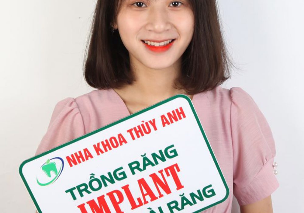 cay-ghep-implant cay-ghep-implant