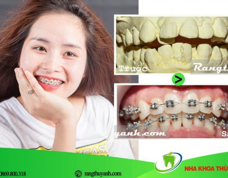 chup-anh-khi-nieng-rang chup-anh-khi-nieng-rang