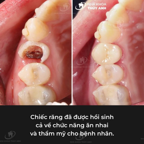 dieu-tri-tuy-Bac-Giang -1 (1) dieu-tri-tuy-Bac-Giang -1 (1)