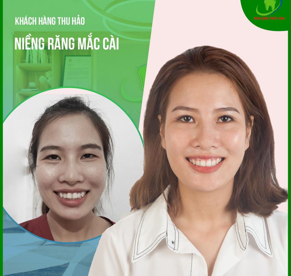 nguyen-nhan-sai-lech-khop-can nguyen-nhan-sai-lech-khop-can