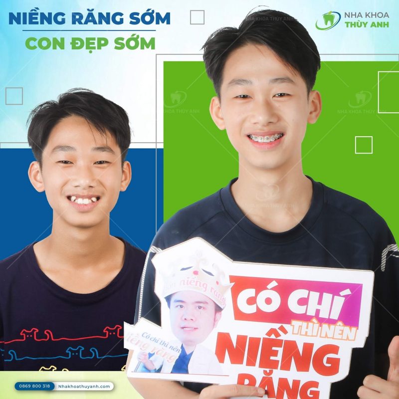 nieng-rang-bac-giang-1 (1) nieng-rang-bac-giang-1 (1)