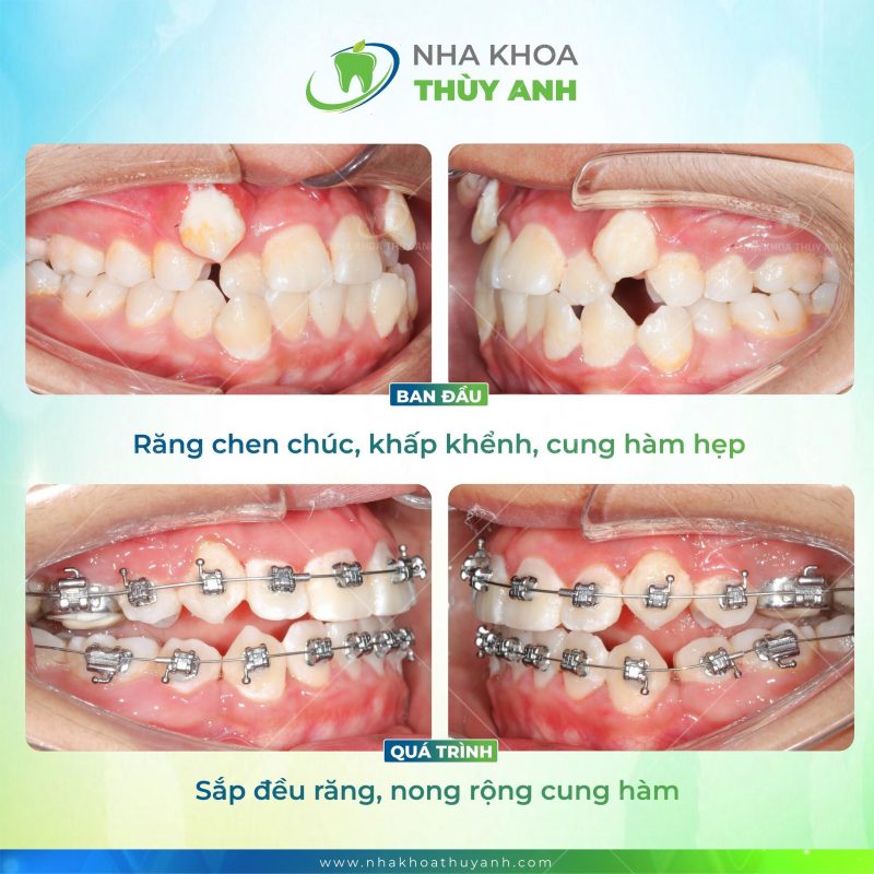 nieng-rang-bac-giang nieng-rang-bac-giang
