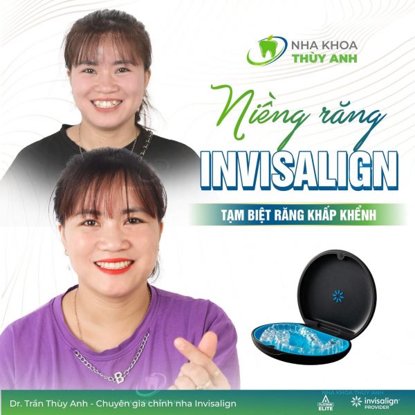 nieng-rang-khap-khenh-Thai-Nguyen -2 (1) nieng-rang-khap-khenh-Thai-Nguyen -2 (1)