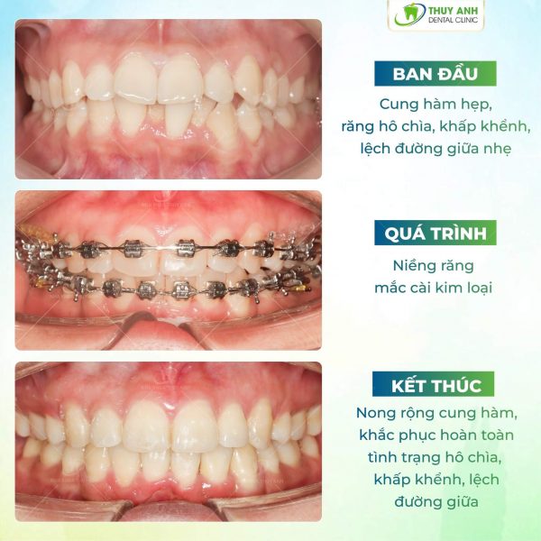 nieng-rang-mac-cai (1) nieng-rang-mac-cai (1)