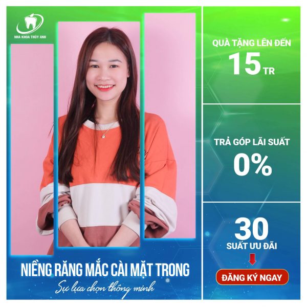 nieng-rang-mac-cai-mat-trong-2 (1) nieng-rang-mac-cai-mat-trong-2 (1)