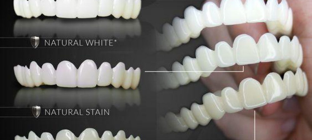 Thẩm mỹ răng tại Nha khoa Minh Châu giúp bạn có được hàm răng đẹp, tươi cười tự tin. Với những công nghệ tiên tiến, các chuyên gia đã tạo ra những bộ răng hoàn hảo, gần như giống thật.