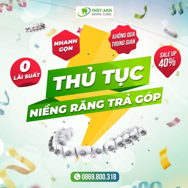 thu-tuc-nieng-rang-tra-gop (1)