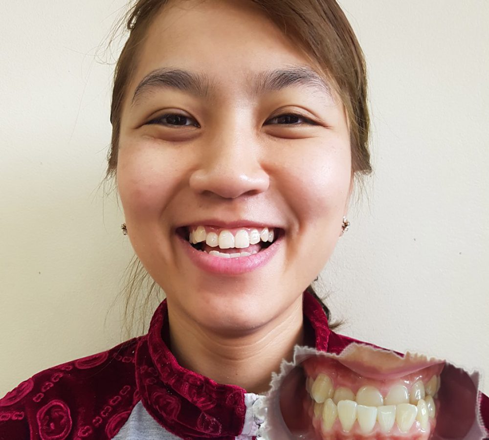 thuy-chi-nieng-rang-5 thuy-chi-nieng-rang-5