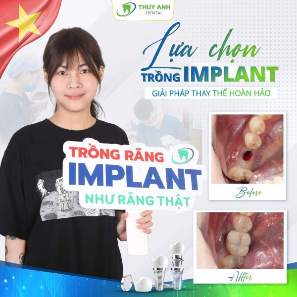 trong-rang-gia-Cau-Giay-2 (1) trong-rang-gia-Cau-Giay-2 (1)