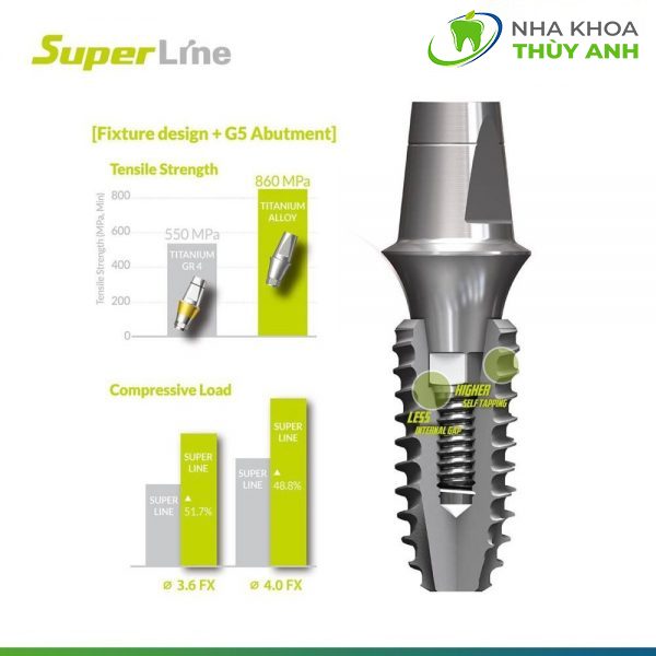 tru-implant-superline-1