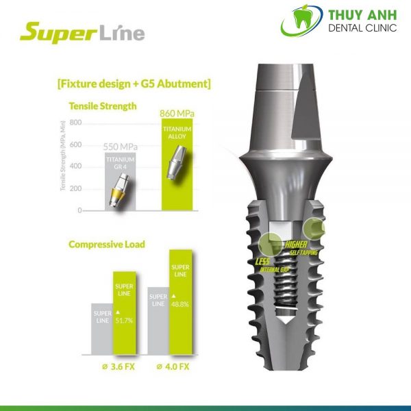 tru-implant-superline-1 tru-implant-superline-1